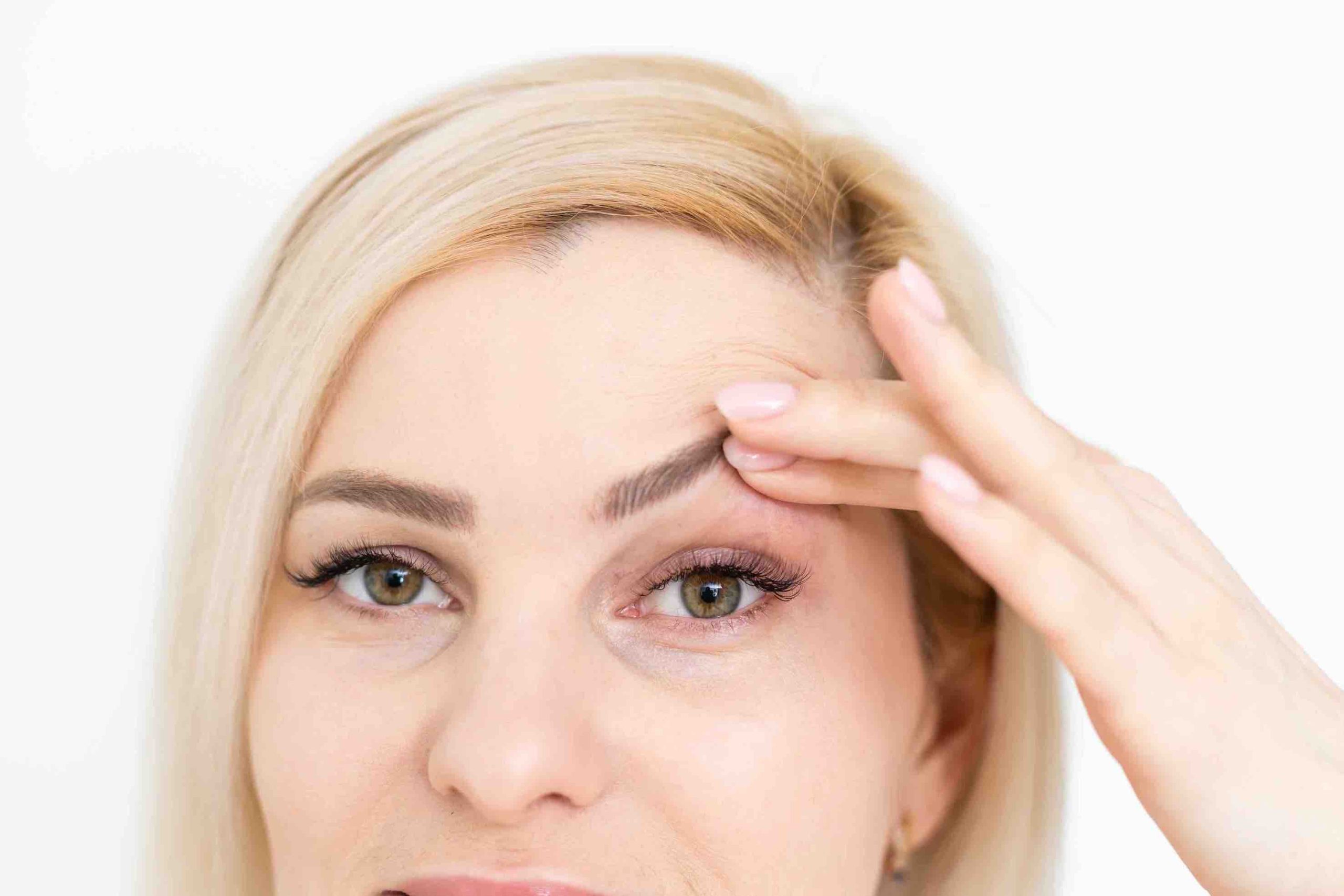 Eye Surgery for Hooded Eyes