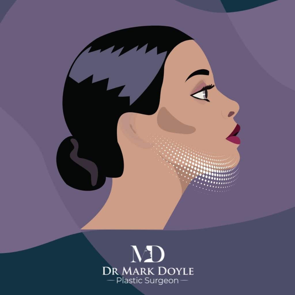 neck and chin fat removal gold coast