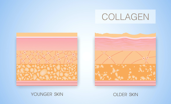 saggy jowls collagen