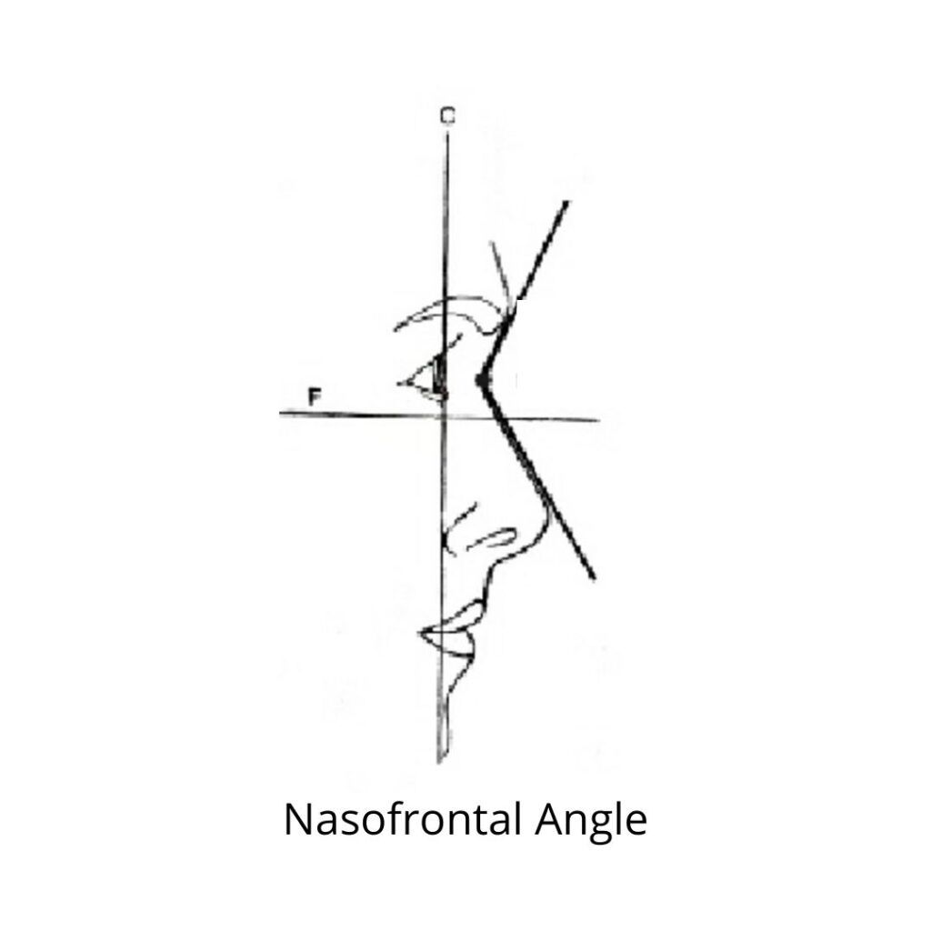 nasofrontal angle