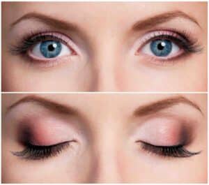 eyelid-surgery-assessment