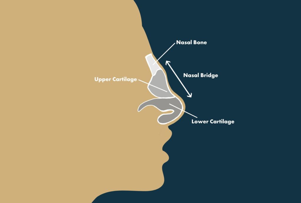 saddle nose